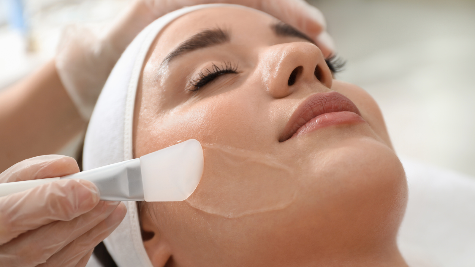 Chemical Peel