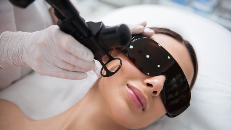 FRACTIONAL CO2 and ERBIUM GLASS LASER